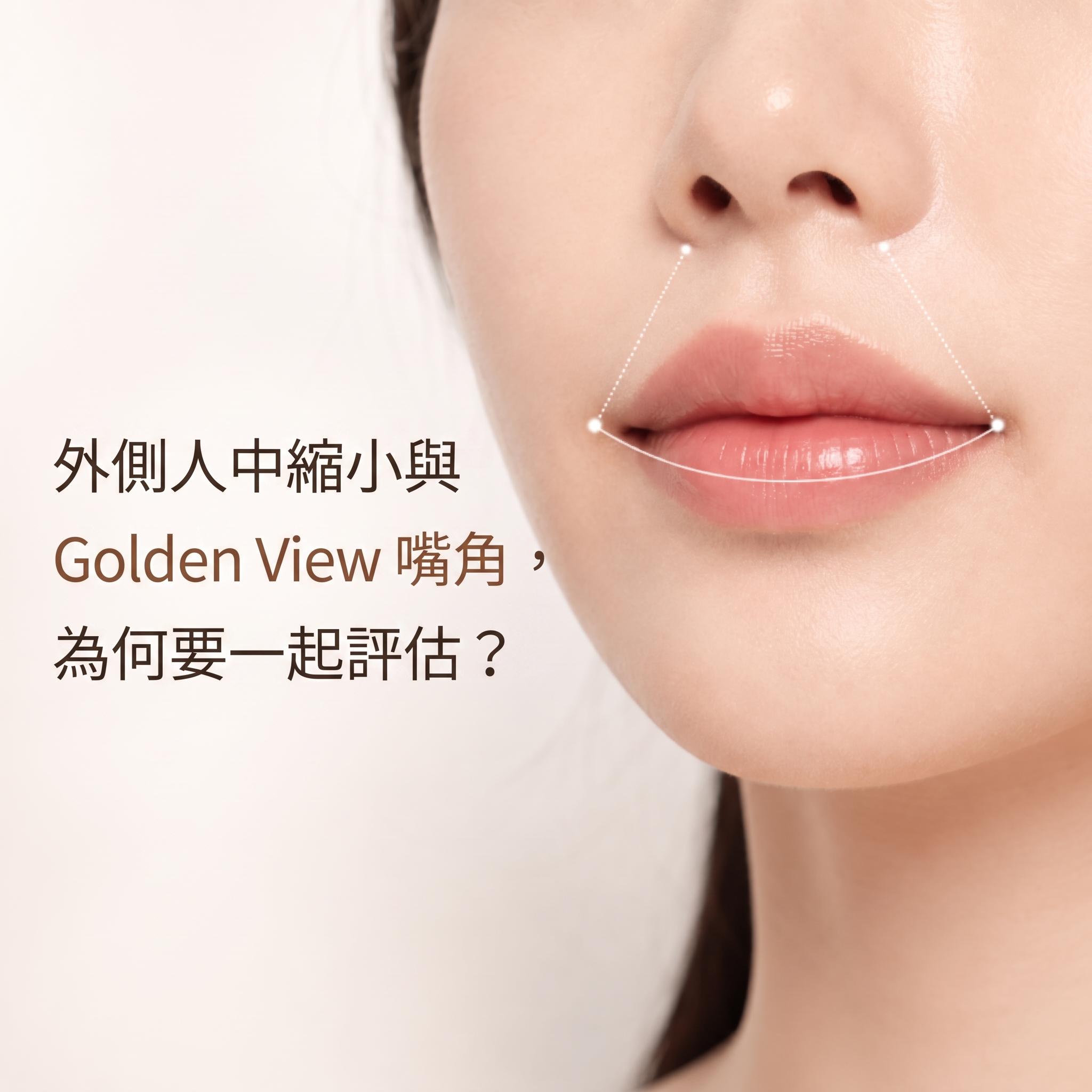 外側人中縮短與黃金比例微笑唇手術，為何一起評估更自然？ | 黃金鑽石整形外科