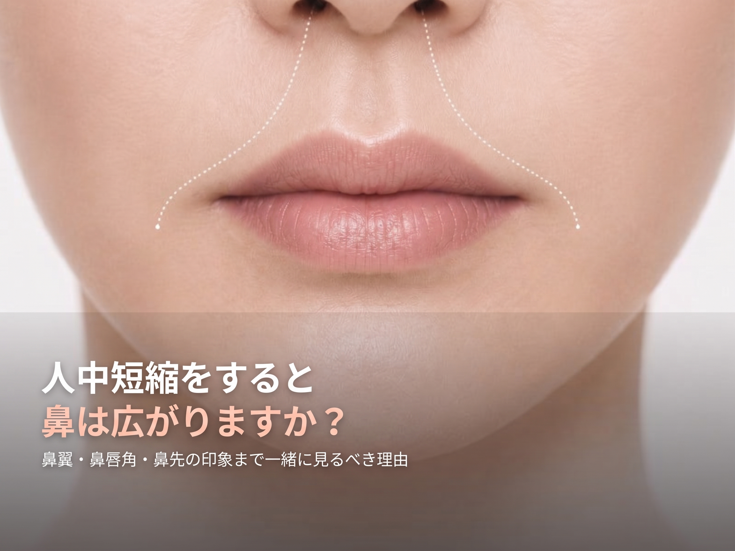 人中短縮をすると鼻が広がる?小鼻が大きくなる?|ゴールデンディアマン