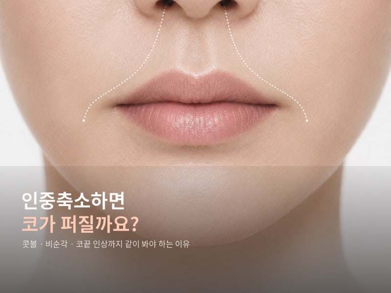 인중축소하면 코가 퍼질까요? 콧볼이 커지나요? | 골든디아망