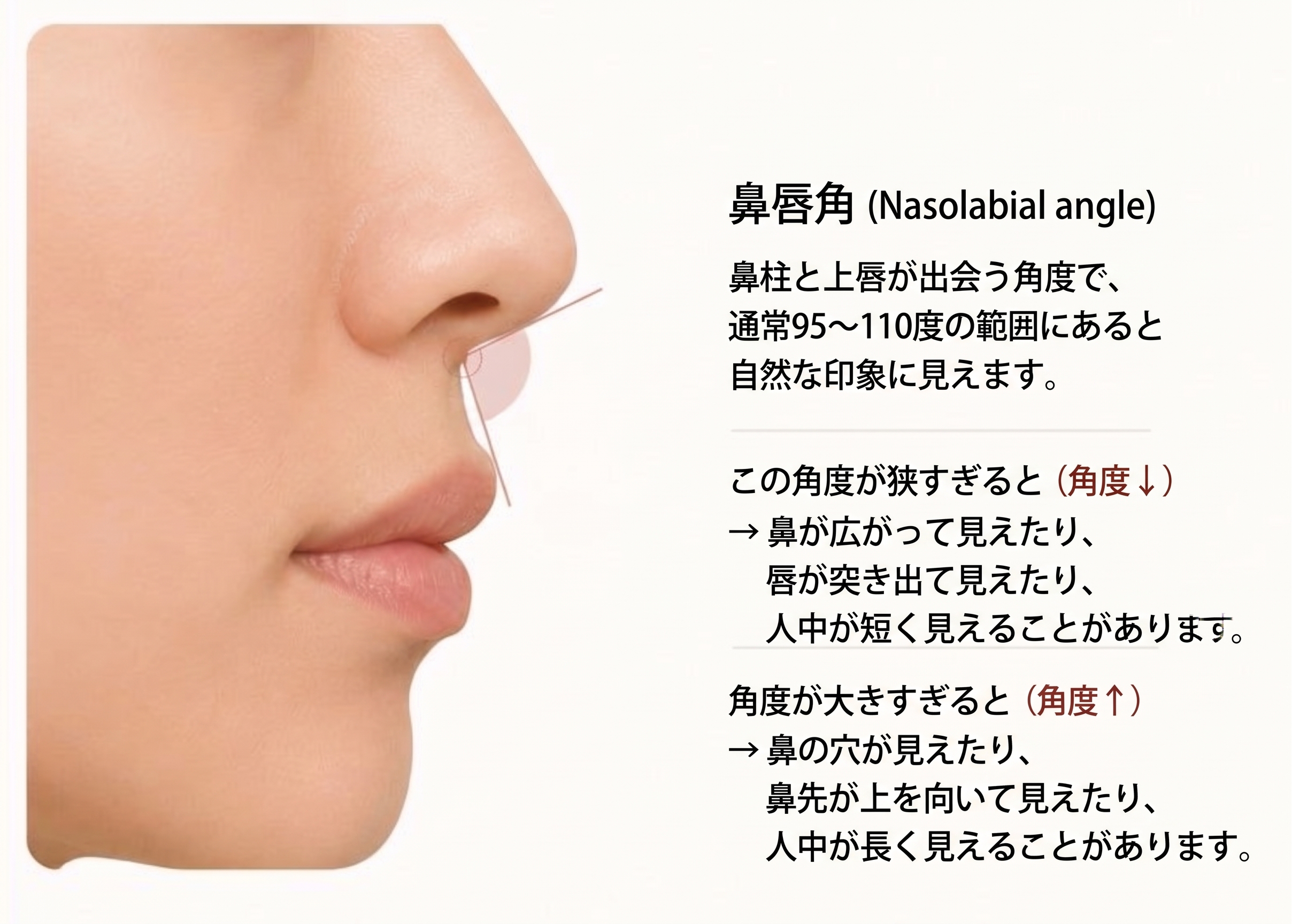人中短縮をすると鼻が広がる?小鼻が大きくなる?|ゴールデンディアマン 사진 4