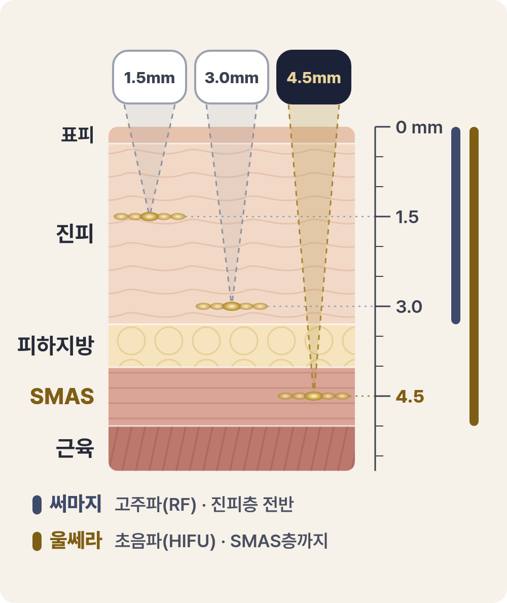 울쎄라는 얼굴 안쪽 어디까지 닿을까 사진 5