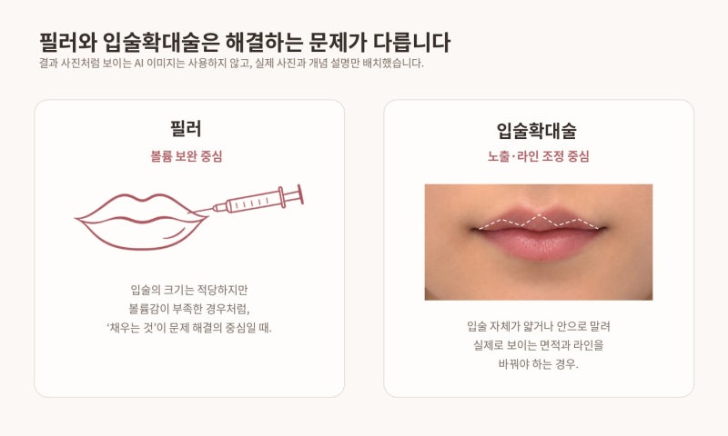 얇고 말린 윗입술, 필러로만 채우면 될까요? | 입술확대술 실제 케이스 리뷰 사진 6