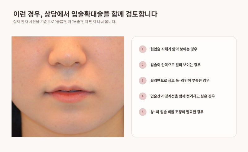 얇고 말린 윗입술, 필러로만 채우면 될까요? | 입술확대술 실제 케이스 리뷰 사진 9