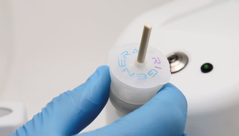 청담 성형외과 초기 탈모 치료에 리제네라액티바 시술