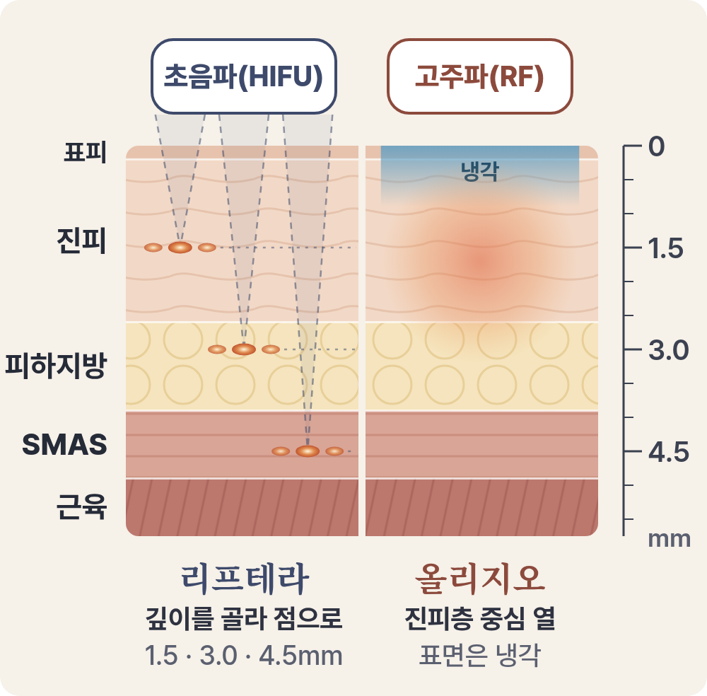 อัลตราซาวด์ (HIFU) กับคลื่นความถี่วิทยุ (RF) ต่างกันอย่างไร? เริ่มดูจากความลึกที่พลังงานไปถึง 사진 4